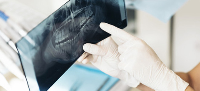 Endodontie Michael Cramer Endodontie Michael Cramer